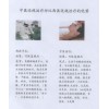 近視恢復信息_河北周到的近視防控手術治療